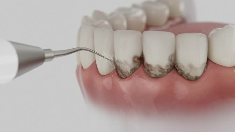 Reliable Teeth Cleaning And Checkup contractor in Cullman County County, AL by Dentist Open Now